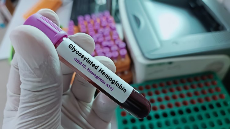 Снимка: IstockPhoto