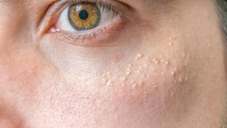 Снимка: IStockphoto