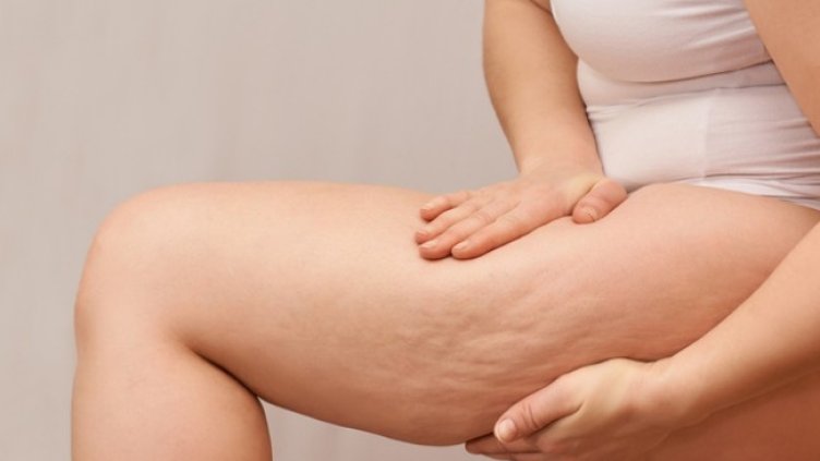 Снимка: Istock