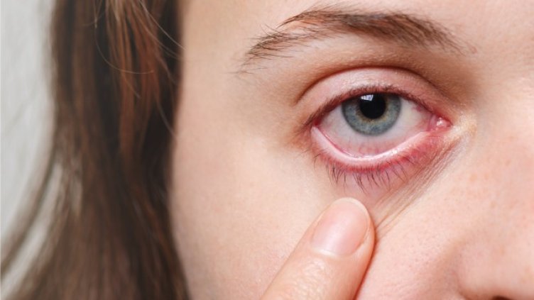 Специалистите алармират: Очите са особено уязвими през лятото, как да ги предпазим?