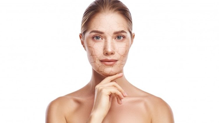 IStockphoto