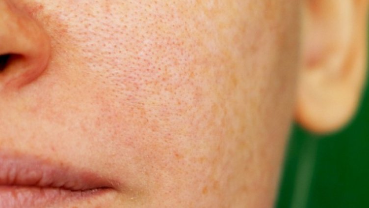 Снимка: Istock