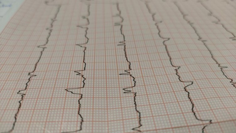 Снимка: Pixabay