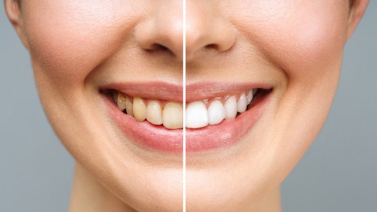 Снимка: Istock