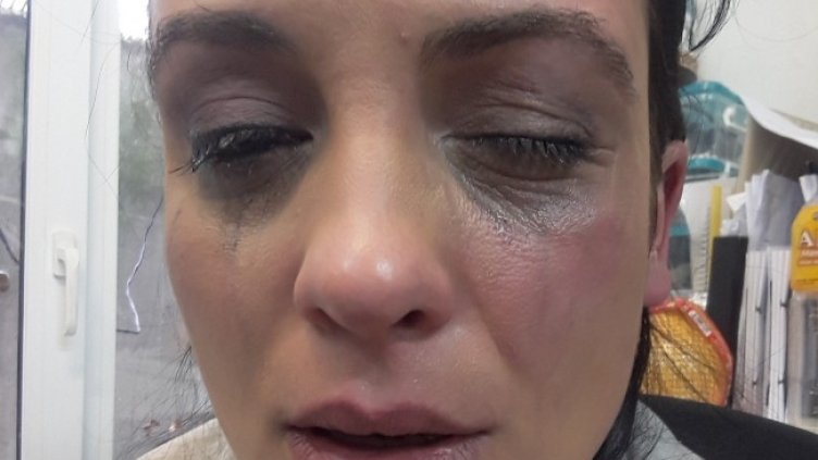 Актрисата разпространи снимки от насилието, което според нея е станало преди повече от пет години