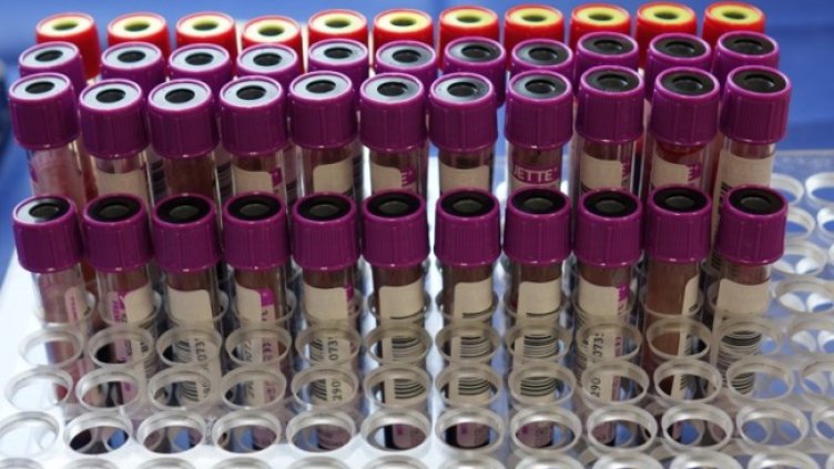 Снимка: Димитър Кьосемарлиев