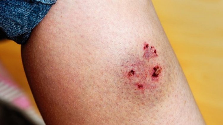 Снимка Фейсбук