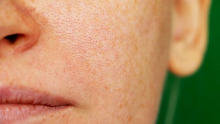 Снимка: Istock