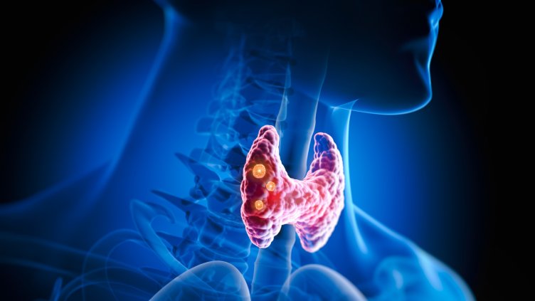 Снимка: istock