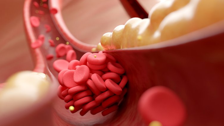 Снимка: istock