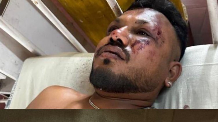 Оцелелият от самолета на Air India Рамеш: Самолетът се разцепи на две, преди да удари земята