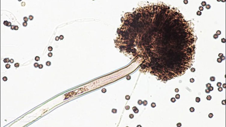 Учени алармират: Смъртоностна гъбичка заплашва САЩ и Европа 