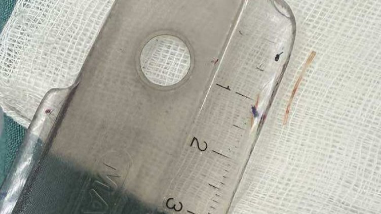 Снимка: УМБАЛ Каспела