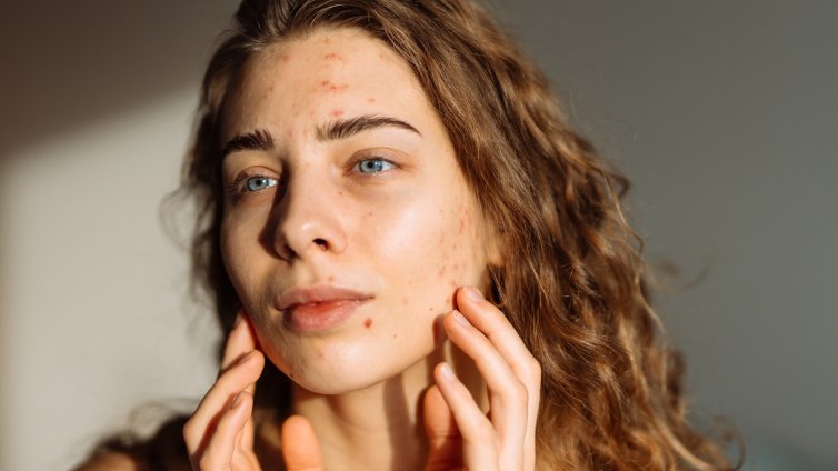 7 съставки, които запушват порите