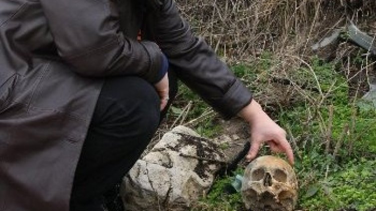 Костите на лицето издават възрастта като бръчките