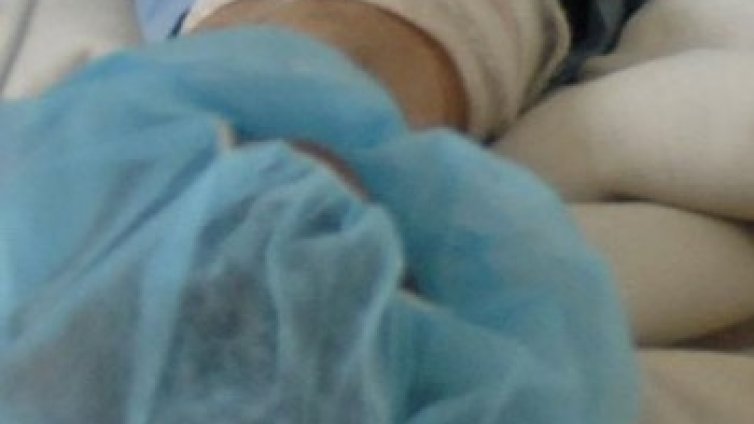 Трима, пострадали при пожари, са приети в Пирогов