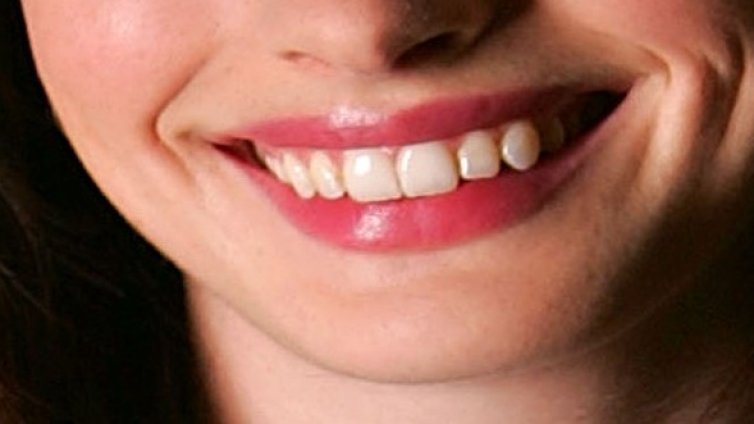 Усмивка във Facebook лиши жена от застраховката й