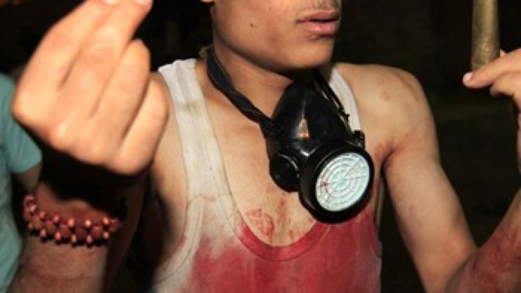 Един убит и 40 ранени в Сана