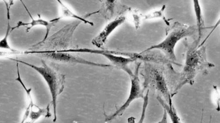 Литий е изпробван срещу болестта на Паркинсон