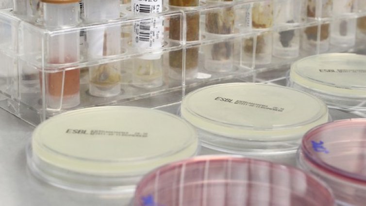 Откриха E.coli в бутилирана вода в Чехия