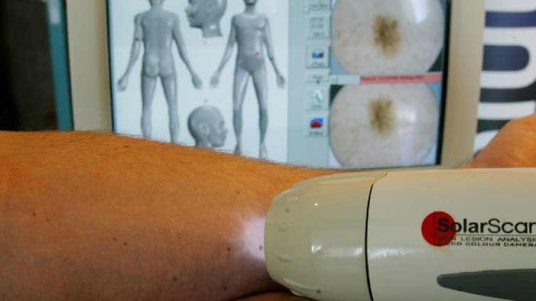 Хомеопатични средства помагат и срещу меланом