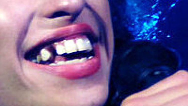 Кой не си мие зъбите? Класация на най-гадните усмивки