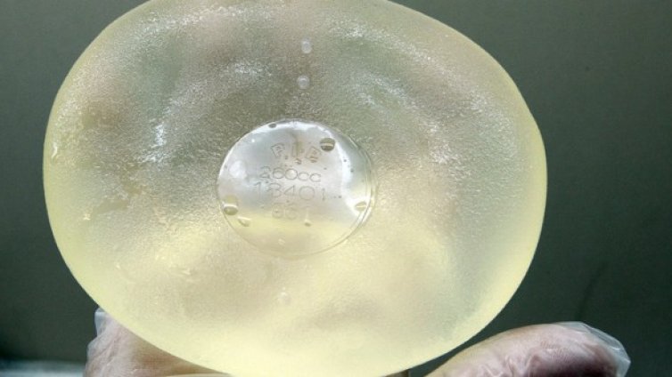 След имплантите тревога будят и хиалуроновите инжекции