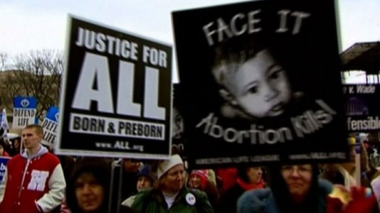 Мъчение ли е да чуеш сърцето на бебето преди аборт по желание? 