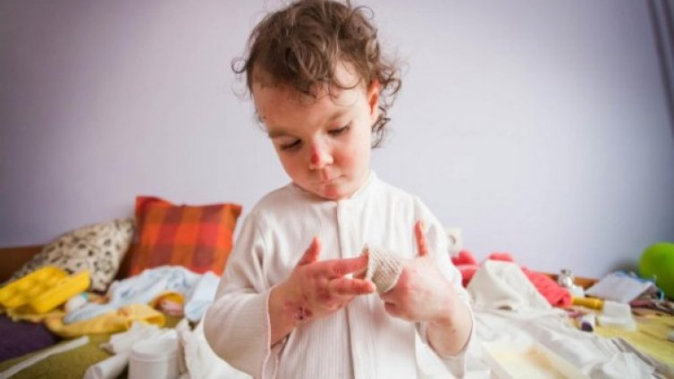 Запознайте се с малката Яна - тя е "пеперудено" дете 