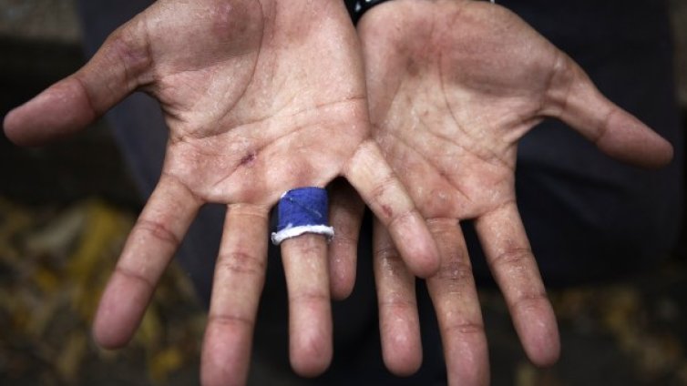 Вредно ли е пукането на ставите?