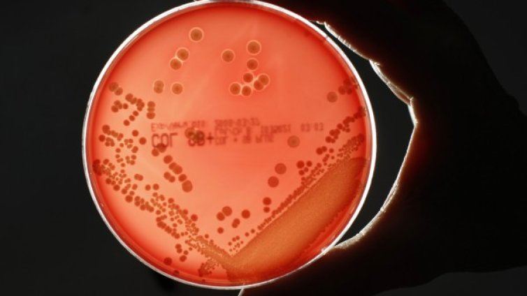 Множествената склероза идва от храната &ndash; възможно ли е?