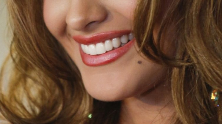 Гингивит&nbsp;и парадонтоза &ndash; основни заболявания на венците