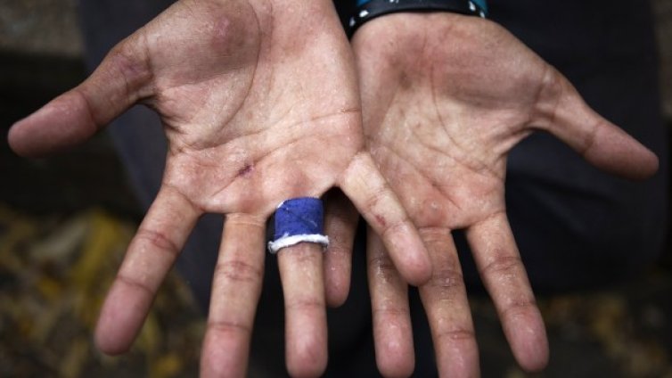 Треперим &ndash; какво ни подсказва състоянието? 