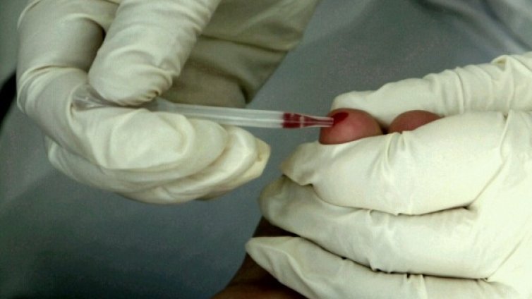 Безплатни прегледи за хепатит B и C в Пловдив