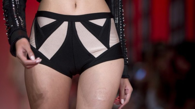 Отпускането на кожата при отслабване може да се предотврати