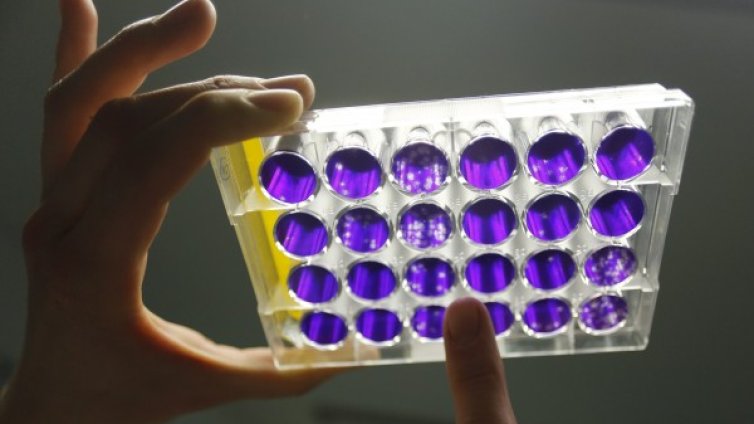 Здравото тяло приютява множество вируси