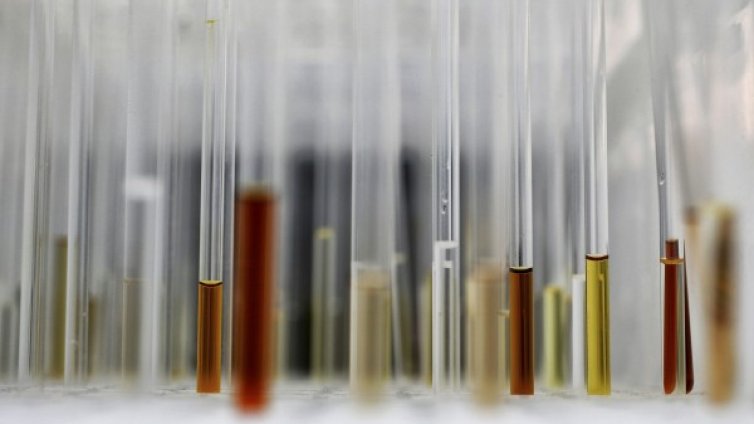 Учени на протест заради съкращения