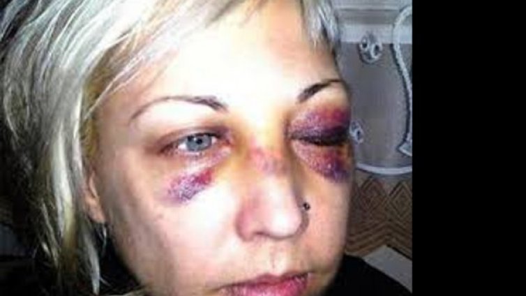 МВР плаща 25 хил. лева за побой над цивилни