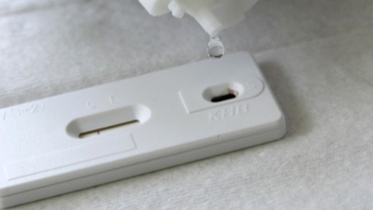 Скандал! Медик крие, че е болен от СПИН