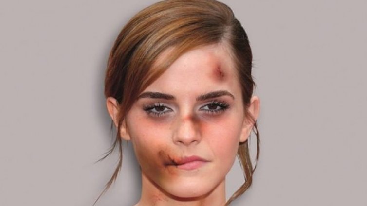 Имунизирани няма! Пребита Мадона, Анджелина...