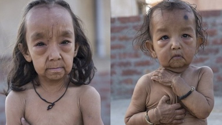 Странният случай с Бенджамин Бътън... в Индия!