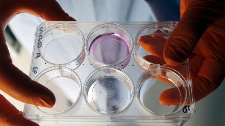 3D принтирани мозъчни тумори &ndash; стъпка към лечение?