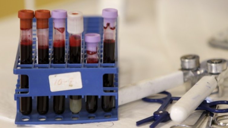 Кръвен тест ще открива депресия