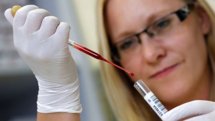 Кои са туморните маркери? За какво се следят?