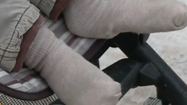 Откраднаха кола, с която дете ходи всеки ден на рехабилитация