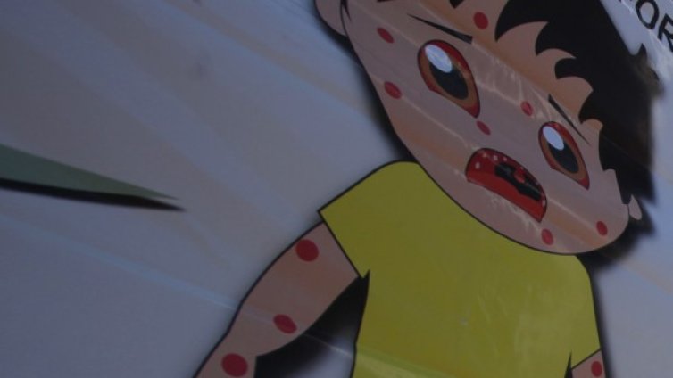 2-годишно от "Столипиново" &ndash; със съмнение за морбили