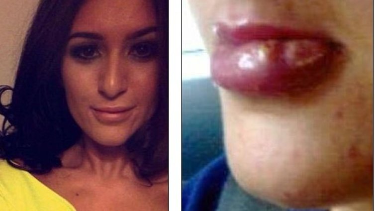 Опасна суета: Вместо "Устни на Пепеляшка" &ndash; кошмар