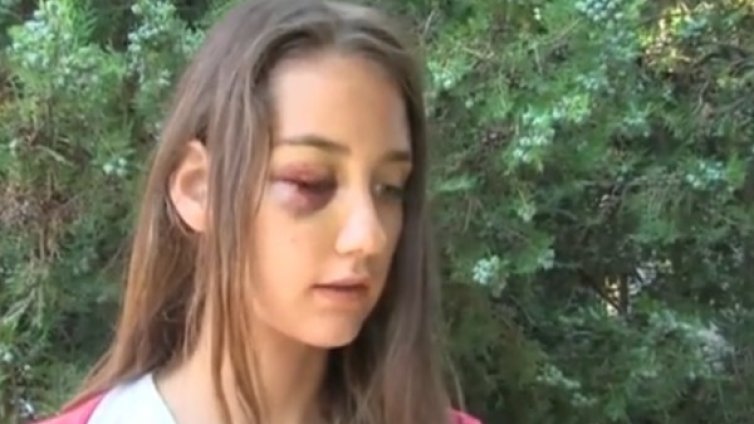 Психар окървави момиче и баба, вече е съден за побой