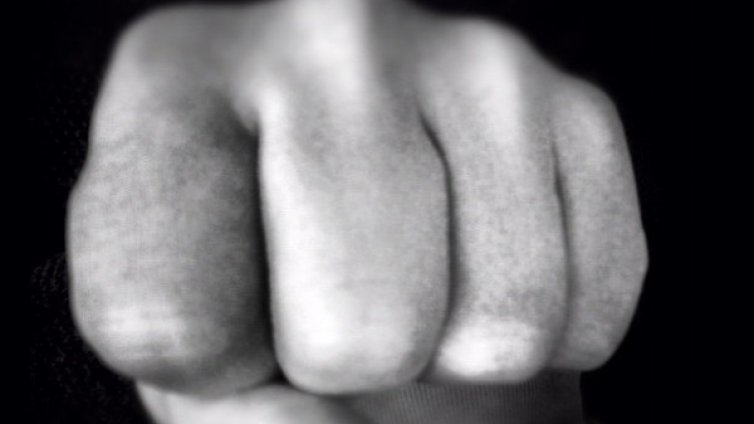 След забележка: Нападнаха лекар от Спешното в Добрич