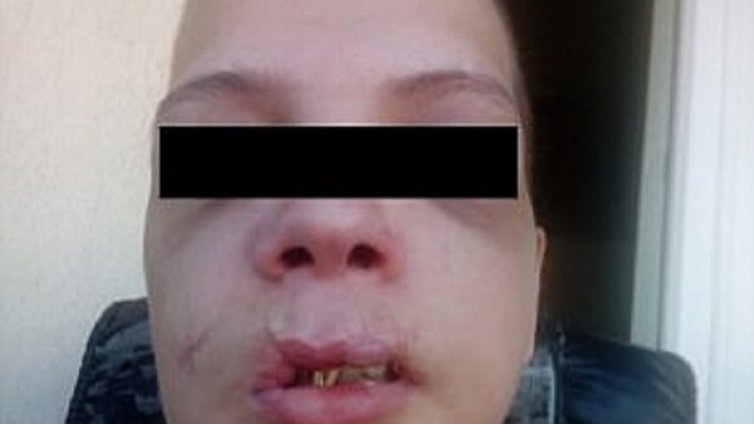 Бой, изтезания... Български сводник преби жестоко секс робиня